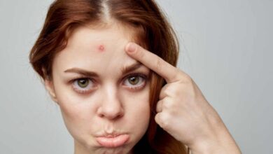 حساسية الوجه​: ما أنواعها أسبابها وأعراضها؟